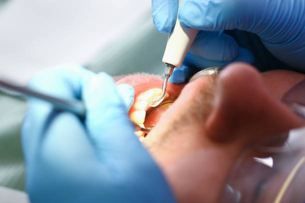 Best Dental Abscess Treatment in Sutton Alpine, AK